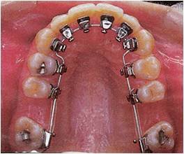 smile designing in pune