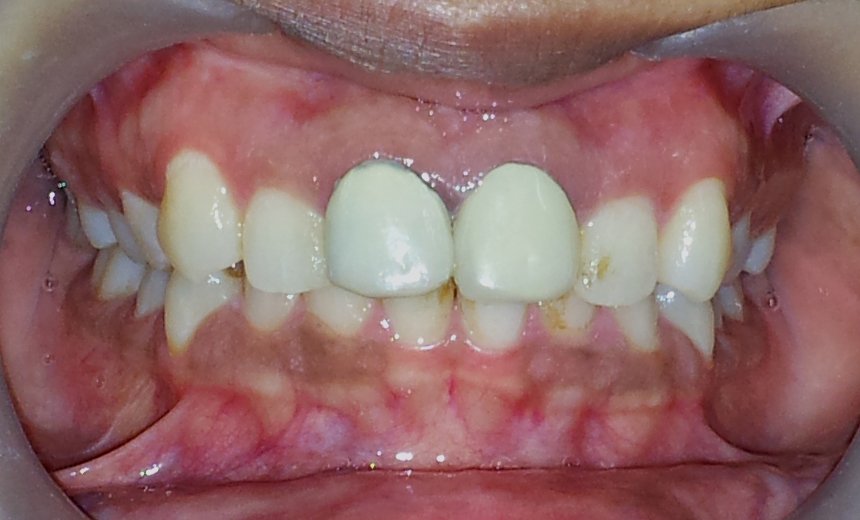 Dental Clinic Services In Hadapsar