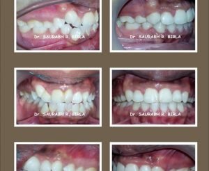dentistry results pune
